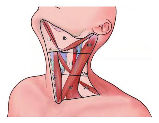 image_category: DIAGRAM/颈部淋巴结分区示意图 | body_region: 头 | specialty: 耳鼻喉头颈外科 | summary: 该图展示了人体颈部淋巴结的临床标准分区(I-VI区),用于指导头颈部肿瘤的诊断与治疗。