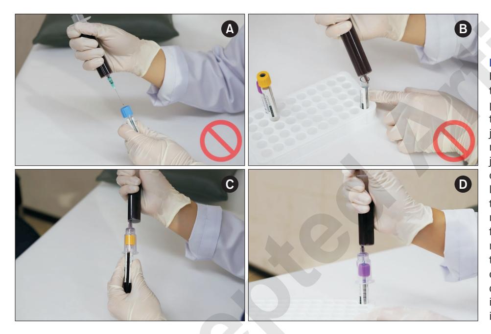 【Standards and Practice Guidelines for Venous Blood Collection: Consensus Recommendations from the Korean Society for Laboratory Medicine】Phlebotomy procedure