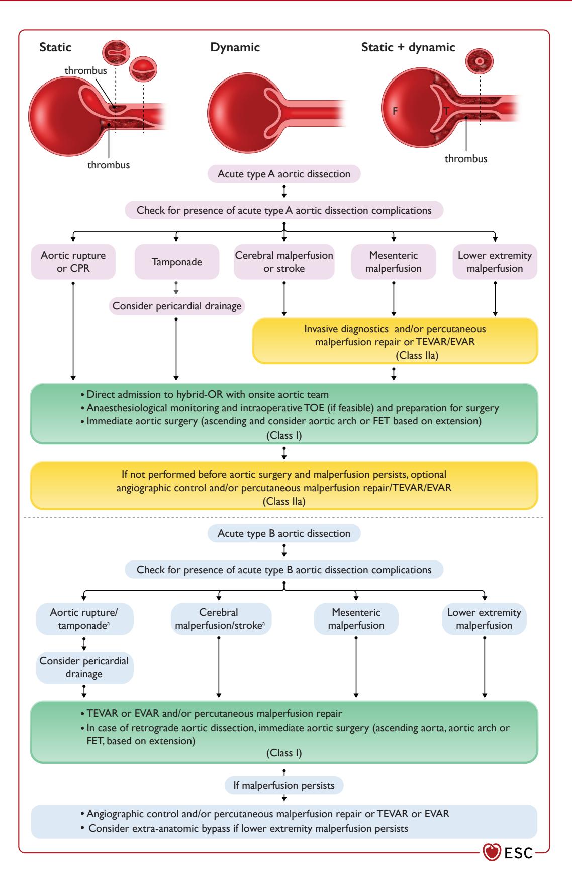 【2024 ESC Guidelines for the management of peripheral arterial and aortic diseases: Developed by the task force on the management of peripheral arterial and aortic diseases of the European Society of Cardiology (ESC) Endorsed by the European Association for Cardio-Thoracic Surgery (EACTS), the European Reference Network on Rare Multisystemic Vascular Diseases (VASCERN), and the European Society of Vascular Medicine (ESVM) 】Clinical management algorithm