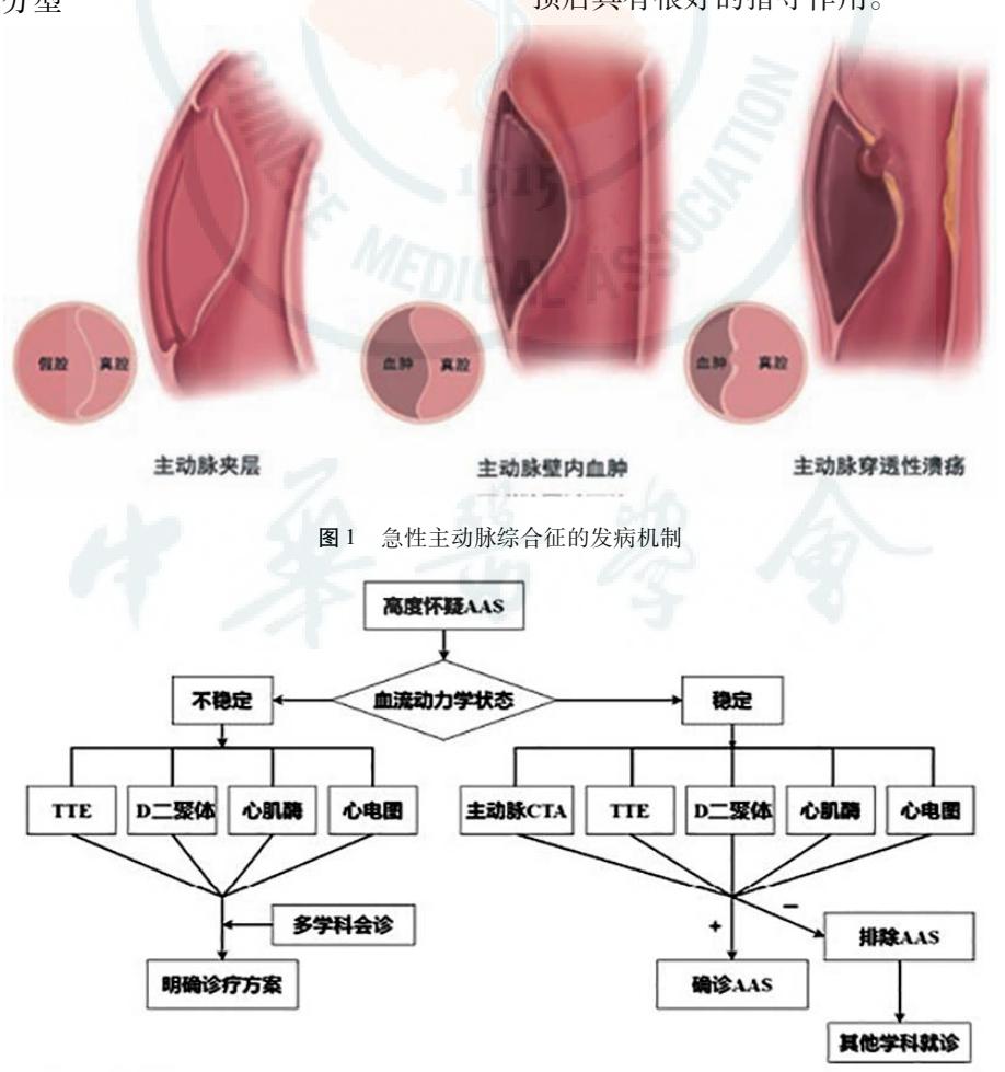 image_category: DIAGRAM/急性主动脉综合征诊疗流程图与发病机制示意图 | body_region: 胸 | specialty: 心血管内科/血管外科 | summary: 展示了急性主动脉综合征(AAS)的三种病理类型及基于血流动力学状态的临床诊疗路径。