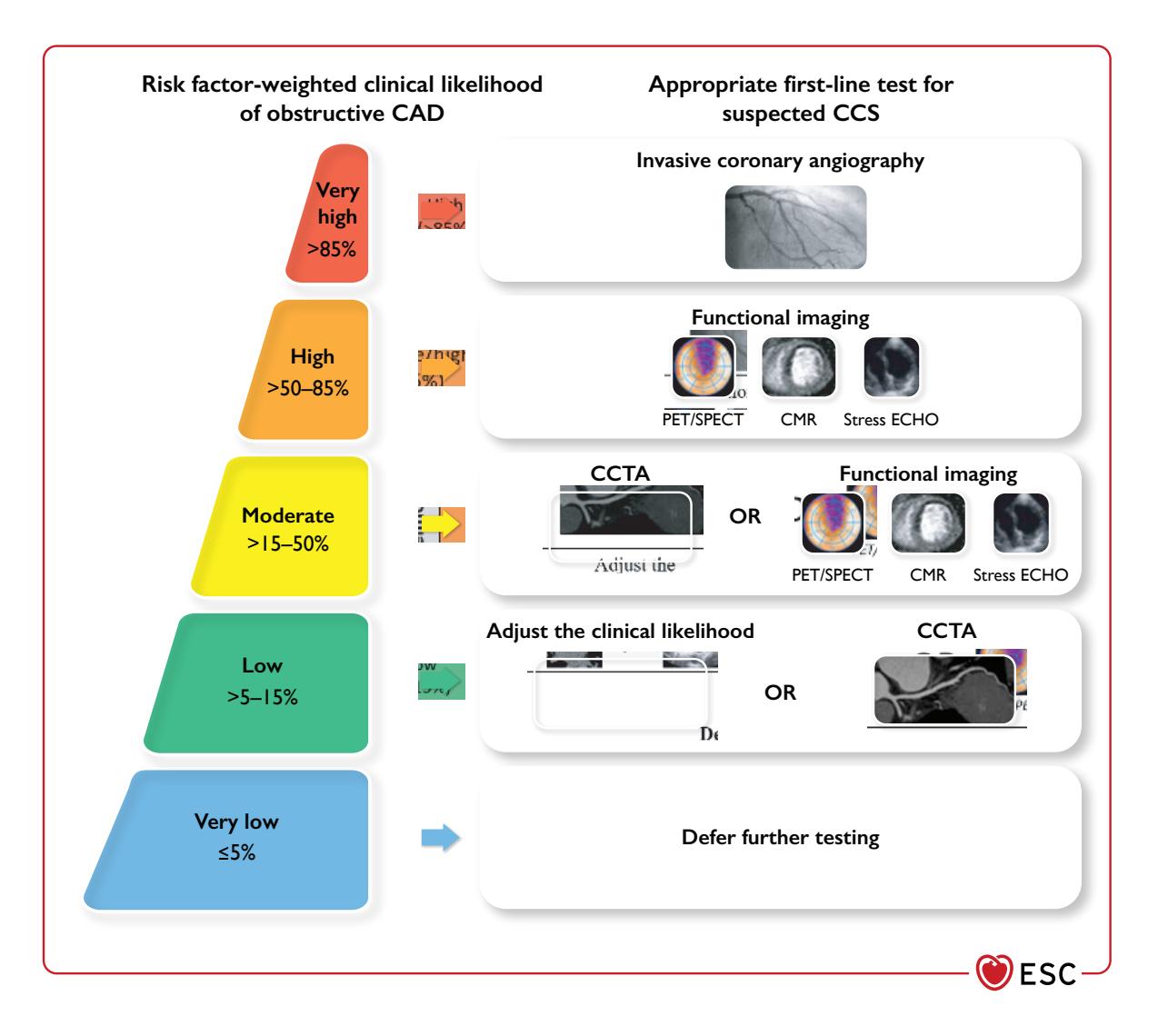 【ESC 2024指南】疑似CCS患者的一线诊断检查推荐