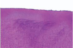 【Pathogenesis-based classification of rickets】Pathogenesis-based classification of rickets