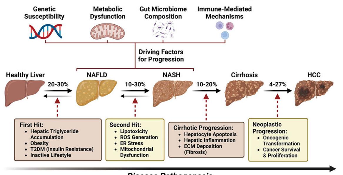【Disease Pathogenesis Diagram】NAFLD to HCC Progression