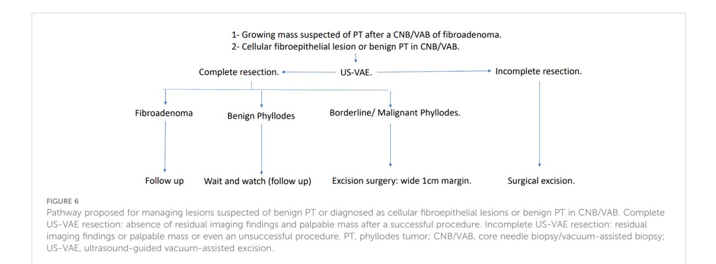 【Vacuum-assisted excision: a safe minimally invasive option for benign phyllodes tumor diagnosis and treatment-a systematic review and meta-analysis】Clinical management algorithm for breast lesions