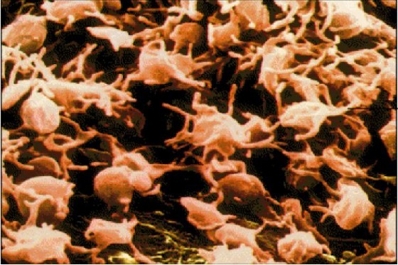 Cancer cell：血小板可促进癌症转移