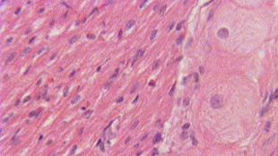Cell Stem Cell：证实心脏也有自产的干细胞