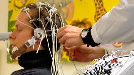 Brain：英科学家发现用电流刺激大脑有助治疗中风