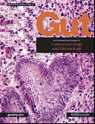 Gut：淋巴细胞性食道炎---一种新的疾病命名