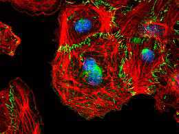 <font color="red">Cell</font>：Raf-1被认为是新血管形成的关键性蛋白