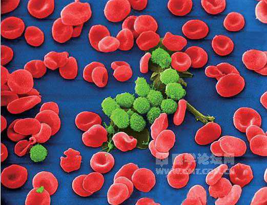 2011版《中国慢性淋巴细胞<font color="red">白血病</font>诊治指南》解读（治疗部分）