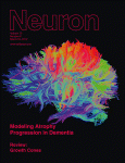 Neuron：双眼看运<font color="red">动物体</font>时为何脑中所看世界是静止的