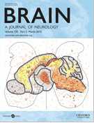 Brain：张旭等在痛觉调节的研究中取得新成果