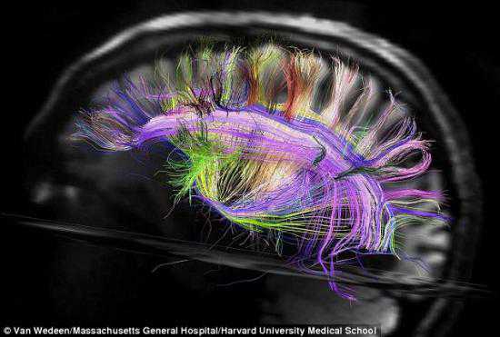 Science：灵长类动物的大脑在新扫描仪下的精细图谱