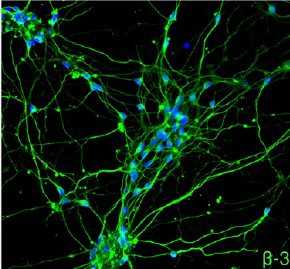 PNAS：干细胞研究新进展或可加快治疗运动神经元疾病