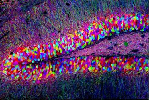 <font color="red">Cell</font>：细胞出版社收集相关大脑论文和艺术图片庆祝2012年大脑意识周