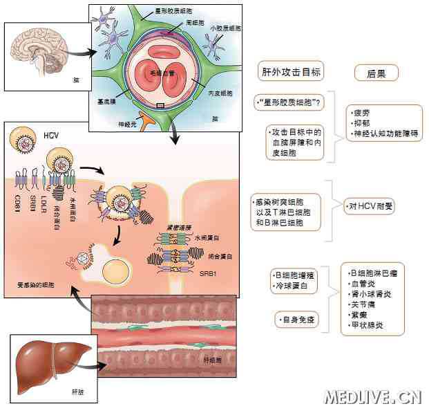 Gastroenterology：丙型肝炎是一种神经<font color="red">系统疾病</font>？