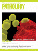 Am J Pathol：调节<font color="red">胰腺</font>癌<font color="red">细胞</font>扩散的蛋白