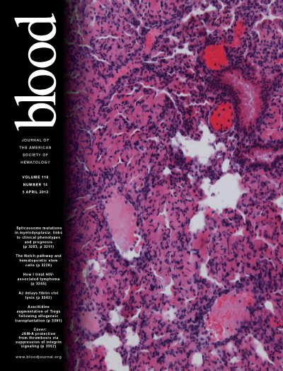 Blood：斑马鱼模型研究发现一种抗白血病新化合物