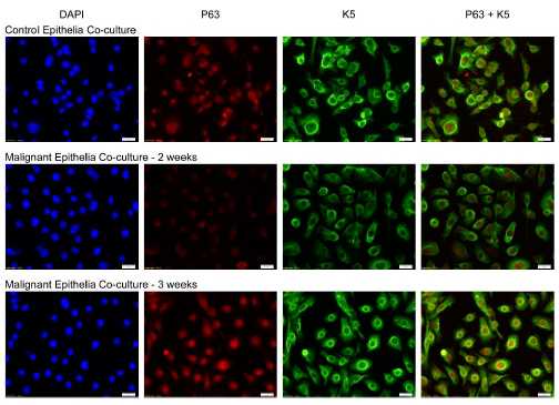 EHP：证<font color="red">实无</font>机砷诱导的癌细胞可将正常干细胞转化为癌干细胞