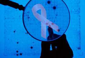 J Nat Can Ins：控制雌激素水平的基因与年轻女性乳腺癌风险相关