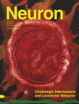 Nueron：新核磁共振技术或能预测痴呆进程