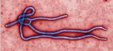 PNAS：抗体治疗让灵长类动物抵抗埃博拉和马尔堡病毒