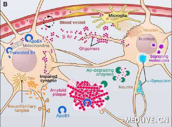 cell综述：阿尔茨海默病30年来的研究进展