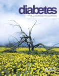 Diabetes：异种器官移植治疗1型糖尿病