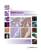 Breast Cancer Res：蛋白Perp与细胞<font color="red">桥粒</font>或成抑制乳腺癌新靶标