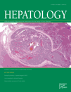 Hepatology ：王國斌等肝癌機理研究獲進展