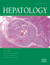 Hepatology ：<font color="red">王国</font>斌等肝癌机理研究获进展
