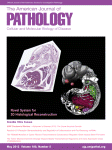 Am J Pathol：基因<font color="red">异常</font>预测前列腺癌复发