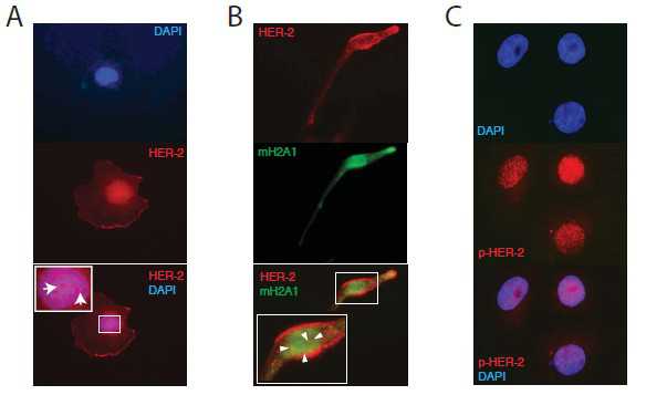 JBC：癌<font color="red">细胞内</font>组<font color="red">蛋白</font>mH2A1.2与HER-2之间相互作用的机制