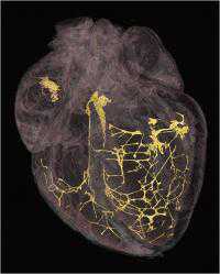 PLoS ONE：心跳紊乱检测有新法 X射线可生成高分辨三维图像