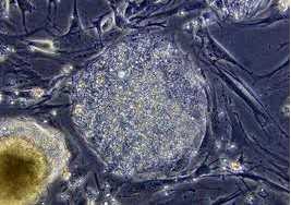 PNAS：利用人胚胎干细胞可成功分化为骨细胞