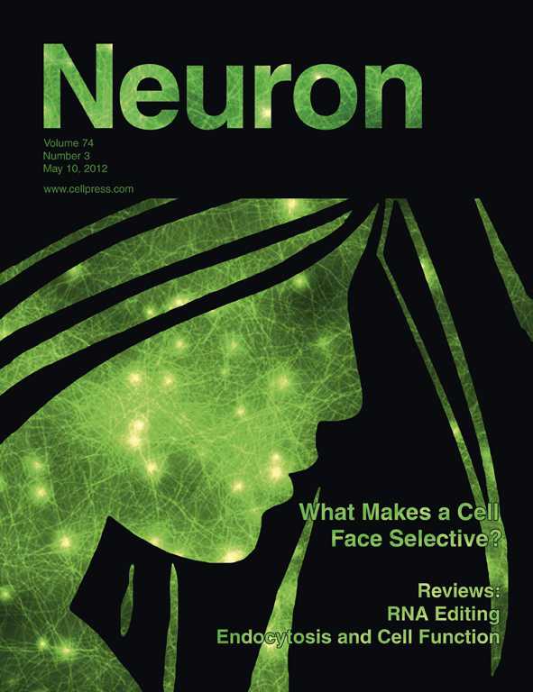 Neuron：科学家发现导致遗忘的机制