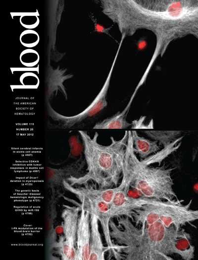 Blood：发现金属蛋白酶组织抑制因子3的新功能