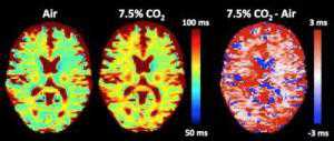 PNAS：脑部酸度变化对大脑正常活动非常重要