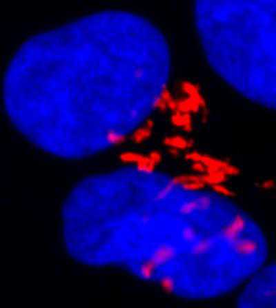 Mol  Cell：胚胎干细胞可以感知<font color="red">DNA</font><font color="red">损伤</font>发生“自杀”行为