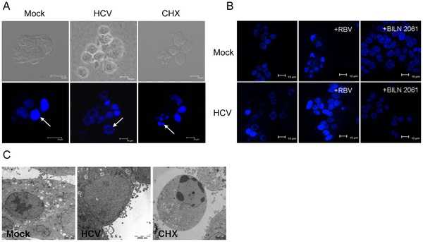 PLoS ONE：发现丙型肝炎病毒诱导胰岛β细胞死亡的新机制