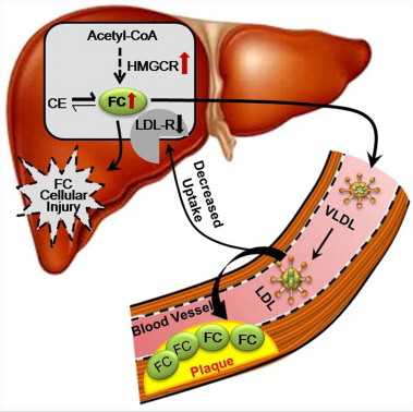 Cell Metab：研究揭示非酒精性脂肪肝患者胆固醇代谢异常