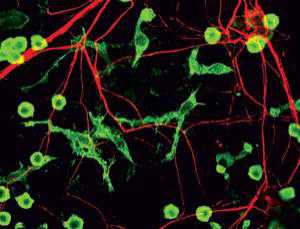 Neuron：小神经胶质细胞可<font color="red">保护</font>机体免于退行性脑病