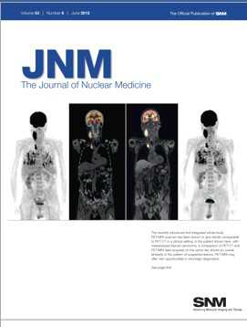 J Nuc Med：新疗法延长前列腺癌病人的生命