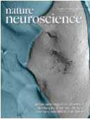 Nat Neurosci：睡眠有助增强运动记忆