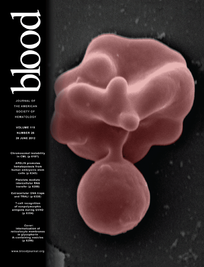 Blood：PTPN22激活AKT促进白血病<font color="red">细胞</font>生存