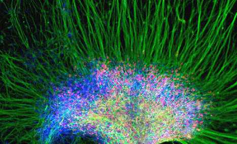二甲双胍的意外副作用：促进大脑新生神经元生长