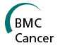 BMC Cancer：雌二醇抑制microRNA诱导乳腺癌细胞增殖