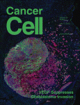 Cancer cell：VEGF能抑制<font color="red">肿瘤</font><font color="red">细胞</font>浸润和间质<font color="red">上皮</font>转化（MET）