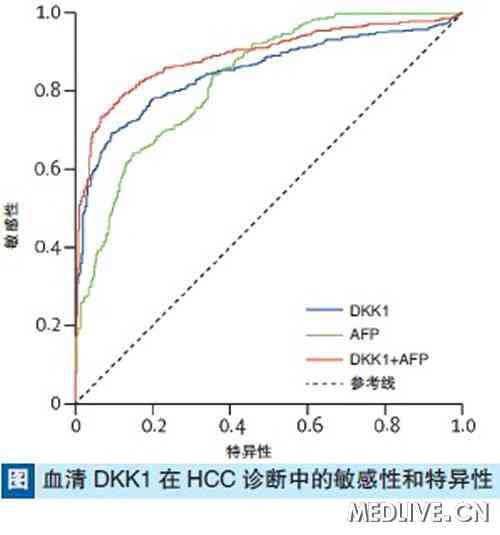 Lancet Oncol:我国学者发现DKK<font color="red">1</font><font color="red">蛋白</font>可用于肝癌诊断