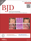 Brit J Dermatol：慢性牙周炎增加病人患上<font color="red">牛皮</font>癣的风险